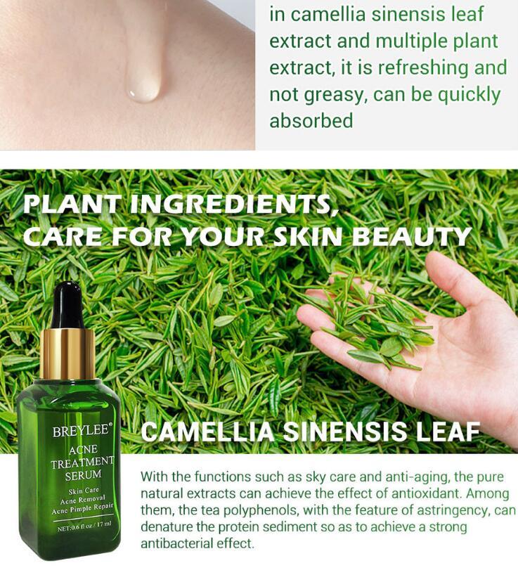 Acne Treatment Serum Facial Repair Oil